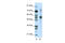 TACO antibody, 28-968, ProSci, Western Blot image 