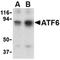 Activating Transcription Factor 6 antibody, ADI-905-729-100, Enzo Life Sciences, Western Blot image 