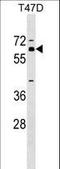 Zinc Finger Protein 554 antibody, LS-C157468, Lifespan Biosciences, Western Blot image 