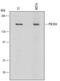 Phosphoinositide-3-Kinase Regulatory Subunit 4 antibody, MAB6104, R&D Systems, Western Blot image 