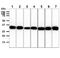 Carbonyl Reductase 3 antibody, GTX57565, GeneTex, Western Blot image 