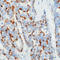 Chromogranin A antibody, LS-C88146, Lifespan Biosciences, Immunohistochemistry paraffin image 