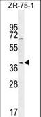 JunB Proto-Oncogene, AP-1 Transcription Factor Subunit antibody, LS-C165377, Lifespan Biosciences, Western Blot image 