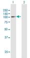 Glycerol-3-Phosphate Acyltransferase, Mitochondrial antibody, H00057678-D01P, Novus Biologicals, Western Blot image 