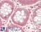 Ubiquitin Protein Ligase E3A antibody, LS-B14302, Lifespan Biosciences, Immunohistochemistry paraffin image 
