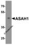N-Acylsphingosine Amidohydrolase 1 antibody, 4741, ProSci, Western Blot image 