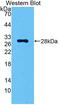 Carbonic Anhydrase 2 antibody, LS-C293133, Lifespan Biosciences, Western Blot image 