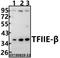 General Transcription Factor IIE Subunit 2 antibody, A11325, Boster Biological Technology, Western Blot image 