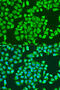 Insulin Like Growth Factor 2 MRNA Binding Protein 3 antibody, 19-372, ProSci, Immunofluorescence image 