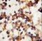 RPTOR Independent Companion Of MTOR Complex 2 antibody, LS-C100810, Lifespan Biosciences, Immunohistochemistry paraffin image 