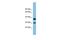 Receptor Transporter Protein 4 antibody, GTX44887, GeneTex, Western Blot image 