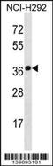 Synaptoporin antibody, 60-184, ProSci, Western Blot image 