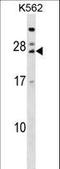 T Cell Receptor Associated Transmembrane Adaptor 1 antibody, LS-C157262, Lifespan Biosciences, Western Blot image 