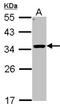 Hydroxysteroid 11-Beta Dehydrogenase 1 antibody, NBP1-32027, Novus Biologicals, Western Blot image 