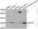 Ciliary Neurotrophic Factor Receptor antibody, A2700, ABclonal Technology, Western Blot image 