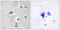 Platelet Derived Growth Factor Receptor Alpha antibody, LS-C117918, Lifespan Biosciences, Immunohistochemistry paraffin image 