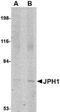 Junctophilin 1 antibody, NBP1-77338, Novus Biologicals, Western Blot image 
