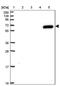 Zinc Finger Protein 555 antibody, PA5-62883, Invitrogen Antibodies, Western Blot image 