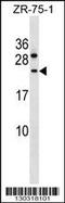 Coiled-Coil Domain Containing 140 antibody, 58-577, ProSci, Western Blot image 