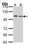 Eukaryotic Translation Initiation Factor 4 Gamma 2 antibody, PA5-27489, Invitrogen Antibodies, Western Blot image 