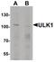 Unc-51 Like Autophagy Activating Kinase 1 antibody, PA5-34542, Invitrogen Antibodies, Western Blot image 