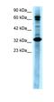 TGF-Beta Activated Kinase 1 (MAP3K7) Binding Protein 2 antibody, orb324417, Biorbyt, Western Blot image 