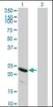 Heat Shock Protein Family B (Small) Member 8 antibody, orb94695, Biorbyt, Western Blot image 