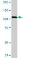 USO1 Vesicle Transport Factor antibody, LS-B6185, Lifespan Biosciences, Western Blot image 