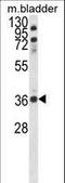 Coiled-Coil Domain Containing 3 antibody, LS-C168412, Lifespan Biosciences, Western Blot image 