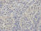Proteasome 26S Subunit, ATPase 2 antibody, A09306, Boster Biological Technology, Immunohistochemistry paraffin image 