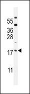 ORMDL Sphingolipid Biosynthesis Regulator 3 antibody, PA5-24232, Invitrogen Antibodies, Western Blot image 