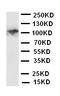 Colony Stimulating Factor 1 Receptor antibody, LS-C313047, Lifespan Biosciences, Western Blot image 