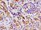 Serine/threonine-protein kinase MARK2 antibody, CSB-PA762568LA01HU, Cusabio, Immunohistochemistry frozen image 