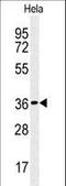 CTD Small Phosphatase Like antibody, LS-C167124, Lifespan Biosciences, Western Blot image 