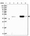 3-ketoacyl-CoA thiolase, mitochondrial antibody, NBP1-84974, Novus Biologicals, Western Blot image 