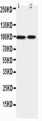 Erythrocyte Membrane Protein Band 4.1 Like 1 antibody, PA2266, Boster Biological Technology, Western Blot image 