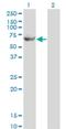 Glycerol Kinase 2 antibody, H00002712-M04, Novus Biologicals, Western Blot image 