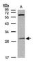 Paired Like Homeobox 2B antibody, PA5-29025, Invitrogen Antibodies, Western Blot image 