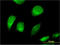 Chloride Voltage-Gated Channel 6 antibody, LS-C196931, Lifespan Biosciences, Immunofluorescence image 