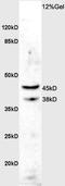 Acetylserotonin O-Methyltransferase antibody, orb2459, Biorbyt, Western Blot image 