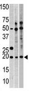 Ribosomal Protein L23a antibody, AP11750PU-N, Origene, Western Blot image 