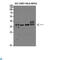 Prostate Transmembrane Protein, Androgen Induced 1 antibody, LS-C813945, Lifespan Biosciences, Western Blot image 