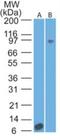 Interleukin 17 Receptor A antibody, NBP2-25258, Novus Biologicals, Western Blot image 