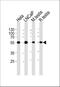 Unc-51 Like Kinase 3 antibody, M07706-1, Boster Biological Technology, Western Blot image 