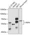 Peripherin antibody, GTX64462, GeneTex, Western Blot image 