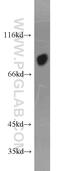 Afamin antibody, 19494-1-AP, Proteintech Group, Western Blot image 