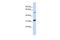 Tandem C2 Domains, Nuclear antibody, GTX45677, GeneTex, Western Blot image 