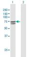 Prolyl 4-Hydroxylase, Transmembrane antibody, H00054681-D01P, Novus Biologicals, Western Blot image 