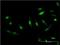 Cullin Associated And Neddylation Dissociated 1 antibody, H00055832-M05, Novus Biologicals, Immunofluorescence image 