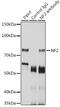 Neurofibromin 2 antibody, GTX35202, GeneTex, Immunoprecipitation image 